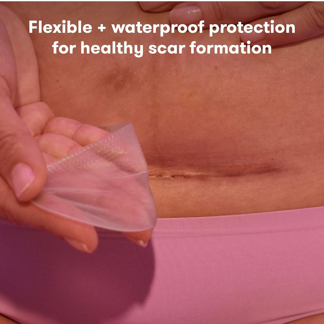 Frida mom silicone scar patch